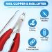 Ingrown Toenail Treatment Kit - Complete 3 in 1 Removal & Pain Relief - 100% Natural Drops Clippers & Nail Lifter - Shop Internationally - Buy Online on GoSupps.com