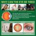 Buy Anti-Aging Eye Cream for Dark Circles & Wrinkles Moisturizing 30g Eye Care Solution - Buy Online on GoSupps.com