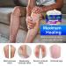 Varicose Veins Cream - Effective Treatment for Legs | Strengthen Capillaries, Improve Circulation | Relief Phlebitis Angiitis Inflammation | 1.7 Fl Oz - Buy Online on GoSupps.com