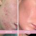 Doll 10 Smooth Assist Overnight Facial Serum - 11% Triple-Acid Resurfacing for Skin Tone Pores & Wrinkles | Vegan & Cruelty-Free - Buy Online on GoSupps.com