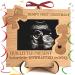 Heart's Sign Bump's First Christmas Ornament 2022 | Bump 1st Christmas Ultrasound Frame Ornament 2022 | Mom To Be and Pregnant Mom Gifts | New Mom Gifts For Women Ultrasound Frame