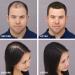 Toppik Hair Building Fibers 3g - Instantly Thicker Hair for Men & Women - 9 Shades Available - Buy Online on GoSupps.com