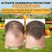 Well&Whole Pumpkin Seed Oil for Hair Growth, Pumpkin Seed Oil Gummies with Saw Palmetto for Men and Women, Prostate Health & Urinary Tract Support, Vegan, Sugar-Free, 60 Counts - Buy Online on GoSupps.com