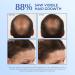 BosleyMD 3-Piece Hair Kit with Saw Palmetto - Shampoo, Conditioner, Treatment - Non Color-Treated Formula for Longer, Thicker, Fuller Hair - Buy Online on GoSupps.com