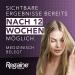 Regaine Women Solution - 20mg/ml Minoxidil for Hereditary Hair Loss 6-Month Supply 2 Packs of 3 x 60ml - Stimulates Hair Growth - Buy Online on GoSupps.com
