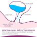 Poise Impressa Incontinence Bladder Supports for Bladder Control, Size 1, 21 Count & Incontinence Pads, Light Absorbency, Long, 24 Count - Buy Online on GoSupps.com
