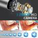 Wireless Earwax Otoscope with Charging Station and 14 Cleaning Tools | 3M High-definition Camera | 3-level LEDs | for iOS & Android - Buy Online on GoSupps.com