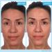SKINN Cr me Reverse with Ferulic Acid, Retinol & Vitamin C - Anti-Aging Cream with Hyaluronic Acid for Wrinkle Reduction & Skin Plumping - Buy Online on GoSupps.com