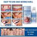 Flipped Warm 60g Temporary Denture Tooth Filling Pearls for Dental Repair - Voltable Fake Teeth Filling Material - Buy Online on GoSupps.com