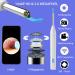 Wireless Ear Wax Removal Kit with Otoscope Camera for iOS & Android - BETISTME Ear Cleaning Tool with Light and Tips for Ears - Buy Online on GoSupps.com