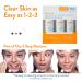 Acne Free Mattifying Toner with Witch Hazel & Glycolic Acid - 8.4 oz x2 - Buy Online on GoSupps.com