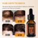 ABERA Hair Growth Serum with Biotin & Castor Oil | Natural Regrowth for Stronger Thicker Hair Beard & Eyebrows for Men & Women - International Shipping Available - Buy Online on GoSupps.com