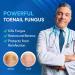 Extra Strength Toenail Fungus Treatment - 25% Undecylenic Acid & Tea Tree Oil for Toes & Fingernails - Blue Formula - Buy Online on GoSupps.com