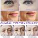 MasaiGGe Retinol Firming Serum Stick collagen peptide firming serum stick antiwrinkle facial cream for reduces fine lines smoothes firms and strengthens face neck and jaw skin 2 30 g 1er Pack - Buy Online on GoSupps.com