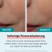 Remescar Immediate Pore Reduction Serum 20ml - Smooths & Minimizes Pores 180 Applications - Clinically Tested - Buy Online on GoSupps.com