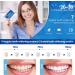 Enamel Safe Teeth Whitening Strips - 14 Sensitive + 4 Instant Strong Whitening Strips - Home Teeth Whitener (7+2 Pouches) - Mint - Buy Online on GoSupps.com
