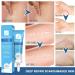 Scar Ointment 15g - Reduces Visibility of Scars | Effective Scar Gel & Cream for Faster Healing - Buy Online on GoSupps.com