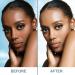 Dark Skin Lightening Cream for Intimate Areas - Brightens, Moisturizes Body, Armpit, Neck, Elbows - Natural Ingredients for Instant Results - Buy Online on GoSupps.com