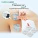 Buy 5x5 Tens Electrode Pads - 16 Pack Self-Adhesive Compatible with Tenscare Neurotrac Auvon & Elle - International Shipping Available - Buy Online on GoSupps.com