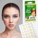 Acne Plaster Hydrocolloid Bandages (216 pcs) - Effective Acne Treatment for Face & Skin | Reduces Pimples & Blackheads Two Universal Sizes - Buy Online on GoSupps.com