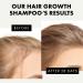 Advanced Hair Growth Shampoo with Argan & Castor Oil - Prevents Hair Loss & Promotes Regrowth - Sulfate & Paraben Free - For Men & Women by Eclat Skin Care - Buy Online on GoSupps.com