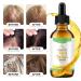 Rice Essential Oil for Hair Growth - 100% Pure Natural Serum for Thin, Damaged Hair - Men & Women - All Hair Types - Buy Online on GoSupps.com