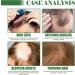 Batana Oil for Hair Growth Hair Care Set with Rosemary Hair Oil & Natural Batana Oil Pure Batana Oil for Healthier Thicker Fuller Hair Prevents Hair Loss & Increases Shine - Buy Online on GoSupps.com