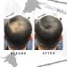 Hair Building Fibre - Long-Lasting Easy Apply Hair Fibre Concealer for Thinning Hair & Balding Spots - Vegan & Cruelty-Free Black Hair Thickening Fibre for Men & Women by Crazy Bull - 22g - Buy Online on GoSupps.com