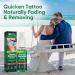 Tattoo Fade Removal Spray - Accelerate Natural Fading at Home | Painless Tattoo Remover - Buy Online on GoSupps.com