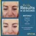 High-Quality Anti-Aging Eye Cream - Wrinkle & Dark Circle Remover (8ml) - Buy Online on GoSupps.com