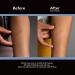 ScarAway Advanced Silicone Scar Sheets - 12 Reusable Sheets for Body, Surgical, Burn, Acne, & Keloid Scars - Buy Online on GoSupps.com
