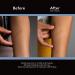 ScarAway Silicone Scar Sheets for Body, Surgical, Burn, Acne, and Keloid Scars - 6 Sheets - Buy Online on GoSupps.com