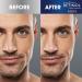 Retinol Men s Charcoal Blackhead Remover Original Anti-Aging Peel-Off Pore Strips for Deep Cleansing & Pore Unclogging | Fast Results in 10 Minutes - Buy Online on GoSupps.com