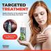 Nyloxin 8 oz Arthritis & Neuropathy Pain Relief Cream - Back, Knee, Foot, Muscle & Joint Pain Relief - Buy Online on GoSupps.com