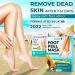 Foot Peel Mask 2 Pack - Exfoliating & Dermatologically Tested - Aloe Vera Formula for Baby Soft Feet - Callus & Dead Skin Remover by SUNATORIA - Buy Online on GoSupps.com