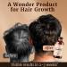 Jamaican Black Castor Oil by June Milnrow | For Hair and Eyelash Growth - Thickens & Strengthens Hair - Moisturizes Skin - 100% Natural - For All Hair & Skin Types (300ML EXTRA DARK) - Buy Online on GoSupps.com