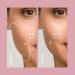 DERMAFLASH ONE Device - Exfoliating & Hair Removal Tool - Sonic Dermaplaning - Blue - Buy Online on GoSupps.com