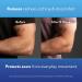 ScarAway Advanced Silicone Scar Sheets - Medical Grade Treatment for Surgical, Burn, Acne & Body Scars - 4 Tan Reusable Strips - Buy Online on GoSupps.com