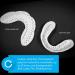 Sova Junior Custom-Fit Mouth Guard for Kids - Spring Green | Night Guard for Clenching & Grinding Teeth - Buy Online on GoSupps.com