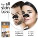 Global Beauty Care 18 Premium Nose Cleansing Strips | Activated Charcoal & Vitamin C Blackhead Remover - International Shipping - Buy Online on GoSupps.com