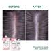 Klorane - Shampoo With Organic Peony - Soothing - Sensitive Scalp - 400ml - Buy Online on GoSupps.com