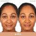 Almay Clear Complexion Acne Foundation Makeup - Lightweight Medium Coverage with Salicylic Acid | Hypoallergenic & Fragrance-Free for Sensitive Skin - 750 Golden, 1 fl oz - Buy Online on GoSupps.com