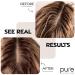 Natural Oily Hair Shampoo & Conditioner Set for Itchy Scalp Treatment - No Sulfates - Women & Men - All Hair Types - Buy Online on GoSupps.com