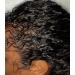 Buy Miracle Hair Growth Oil - Fast Shipping Worldwide | Revitalize Your Hair Naturally - Buy Online on GoSupps.com