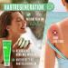 Vitabay Aloe Vera Gel 100% (99.9%) - 2x250ml After Sun Lotion & Sunburn Relief - Natural Moisturizer for Men - Aloe Vera Juice Ointment - Buy Online on GoSupps.com