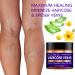 Natural Varicose Veins Cream for Pain Relief - Effective Treatment for Varicose and Spider Veins on Legs - Buy Online on GoSupps.com