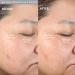 PMD Clean - Intelligent Waterproof Facial Cleaning Device | Silicone Brush & Anti-Aging Massage | SonicGlow Technology for Clear Pores & Tighter Skin - Buy Online on GoSupps.com
