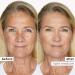 Sugar Rush Skin Treat Concealer - Light-Medium - 4g Full Size - Buy Online on GoSupps.com
