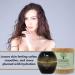 Buy Mountain Top Retinol Facial Moisturizer 1.7oz - Anti-Aging Wrinkle Reducer with 24k Gold Aloe Vera Green Tea & More - International Shipping Available - Buy Online on GoSupps.com