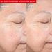 PMD Clean Redvolution - Smart Facial Cleansing Device with Silicone Brush & Red Light Therapy for Smoother Skin Fine Lines Reduction & Firming - Face & Body Care - Buy Online on GoSupps.com